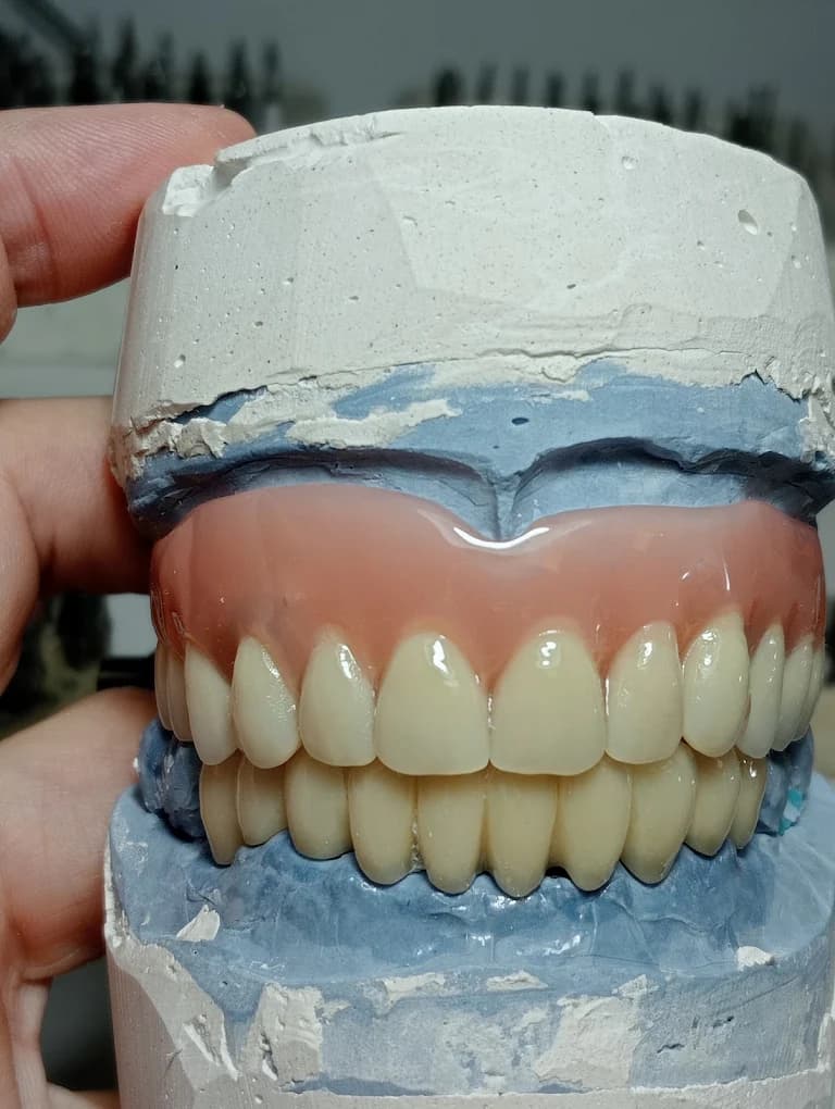 Prótesis dental completa sobre modelo de trabajo, fabricada por Marsadent